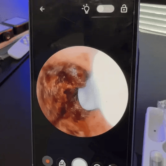 Wax Cleaner — Smart Öronvaxrengörare med HD-kamera